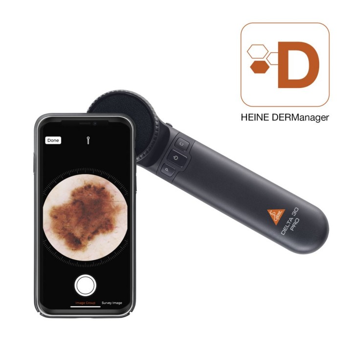 Dermatoscope HEINE DELTA 30 PRO